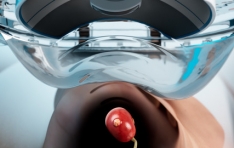 HistoSonics Completes Enrollment in #HOPE4KIDNEY Trial Evaluating Non-Invasive Histotripsy to Treat Kidney Tumors